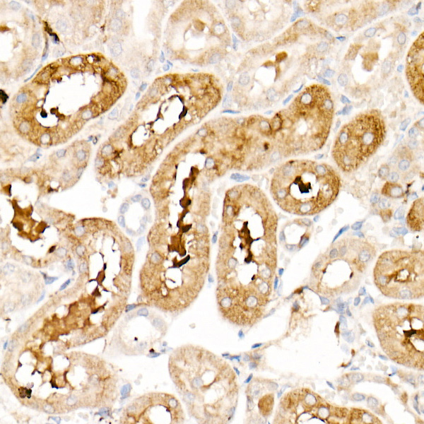 Ferritin Light Chain Rabbit Polyclonal Antibody - Image 8