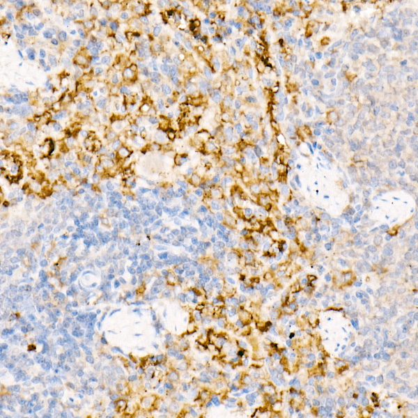 Ferritin Light Chain Rabbit Polyclonal Antibody - Image 9