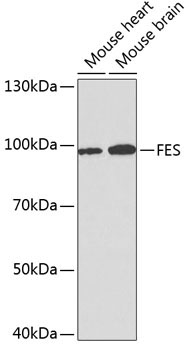 FES Rabbit Polyclonal Antibody