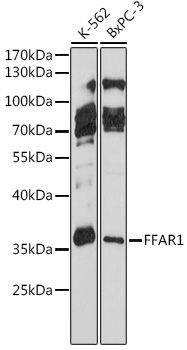FFAR1 Rabbit Polyclonal Antibody