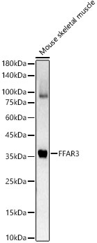 FFAR3 Rabbit Polyclonal Antibody