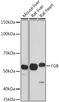 FGB Rabbit Polyclonal Antibody