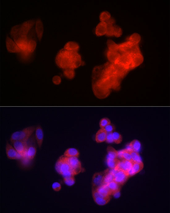 FGB Rabbit Polyclonal Antibody - Image 3