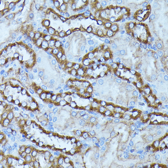 FGD1 Rabbit Polyclonal Antibody - Image 2