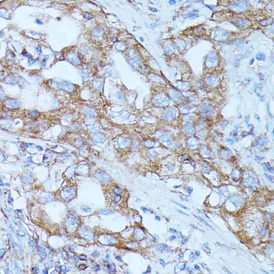 FGD1 Rabbit Polyclonal Antibody - Image 3