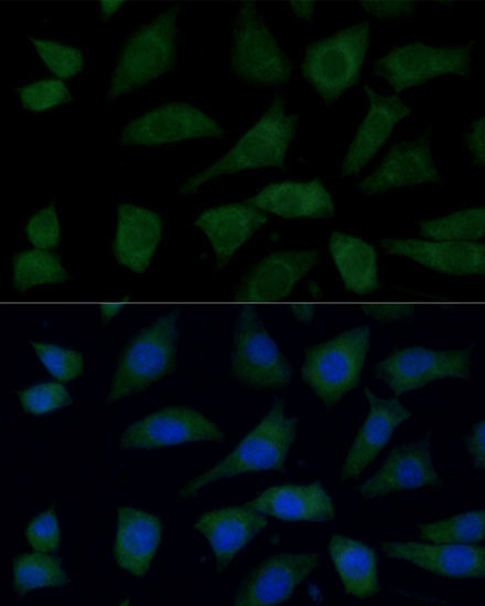 FGD1 Rabbit Polyclonal Antibody - Image 5