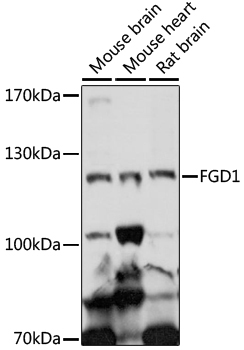 FGD1 Rabbit Polyclonal Antibody