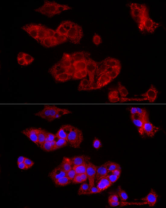 FGF1 Rabbit Polyclonal Antibody