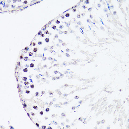 FGF12 Rabbit Polyclonal Antibody - Image 2