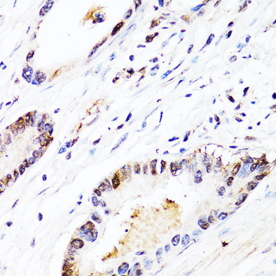 FGF12 Rabbit Polyclonal Antibody - Image 3