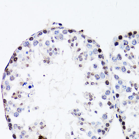 FGF12 Rabbit Polyclonal Antibody - Image 4