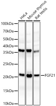 FGF21 Rabbit Monoclonal Antibody