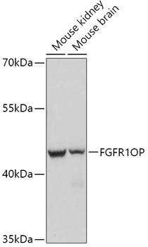FGFR1OP Rabbit Polyclonal Antibody