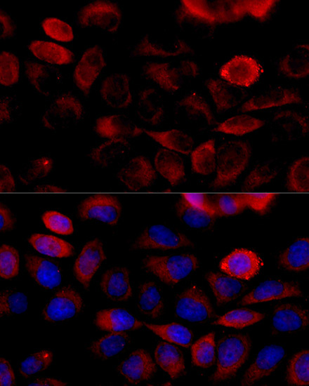 FGFR2 Rabbit Polyclonal Antibody - Image 2