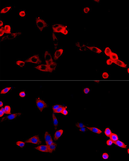 FGFR2 Rabbit Polyclonal Antibody - Image 3
