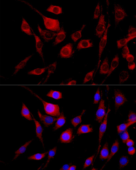 FGFR2 Rabbit Polyclonal Antibody - Image 4