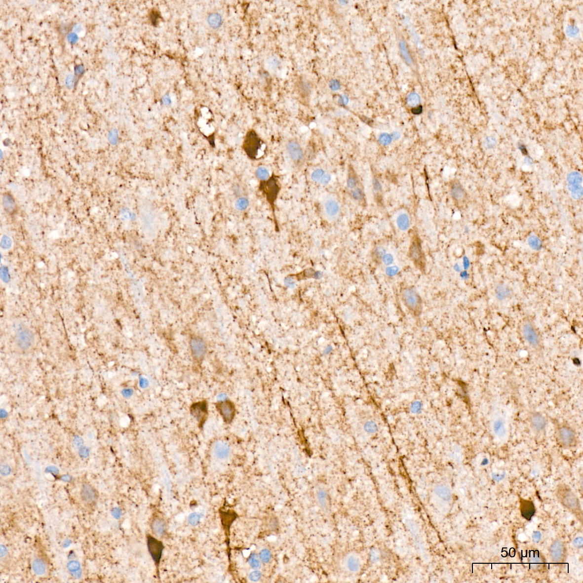 FGFR3 Rabbit Monoclonal Antibody