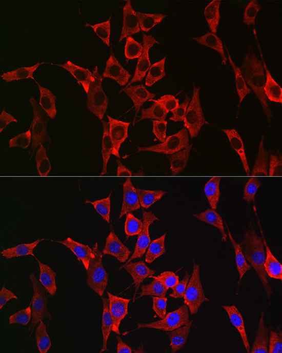 FGFR3 Rabbit Polyclonal Antibody - Image 2