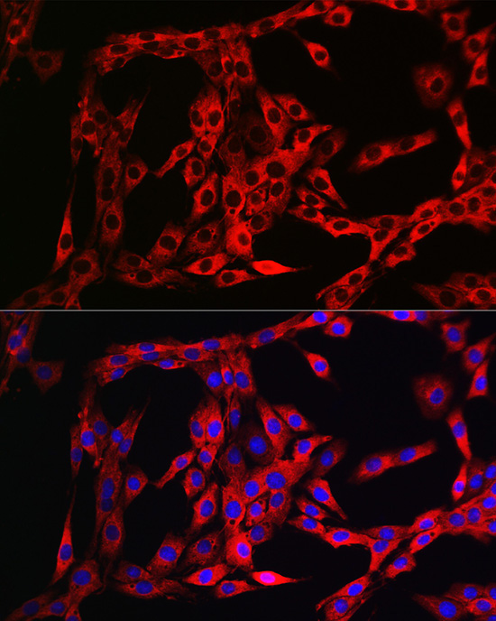 FGFR3 Rabbit Polyclonal Antibody - Image 3