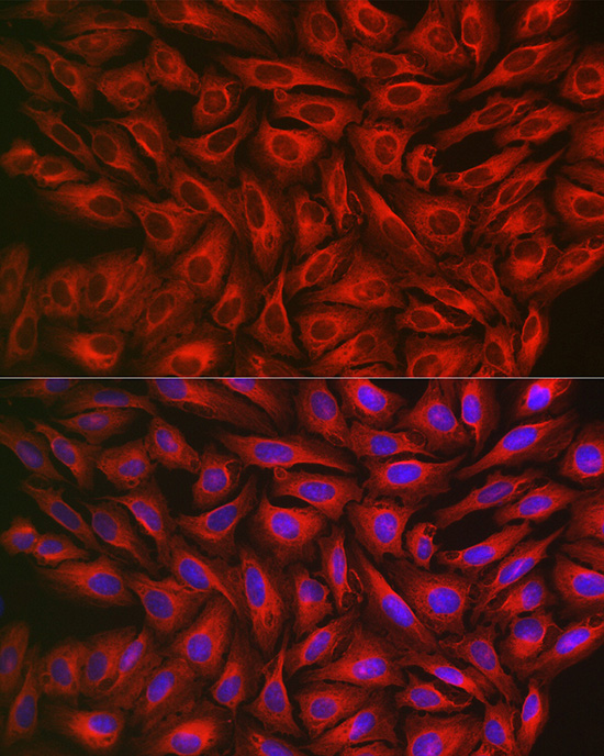 FGFR3 Rabbit Polyclonal Antibody - Image 4