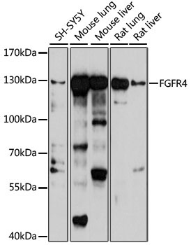 FGFR4 Rabbit Polyclonal Antibody