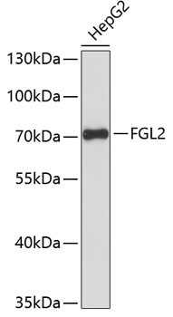 FGL2 Rabbit Polyclonal Antibody