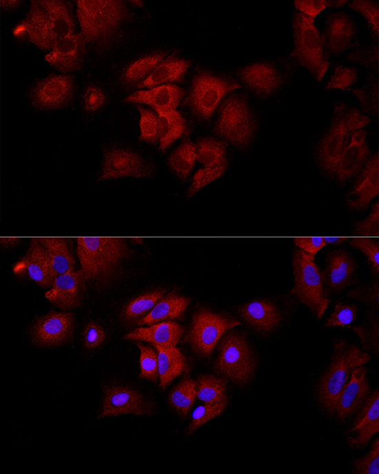 FH Rabbit Polyclonal Antibody - Image 2