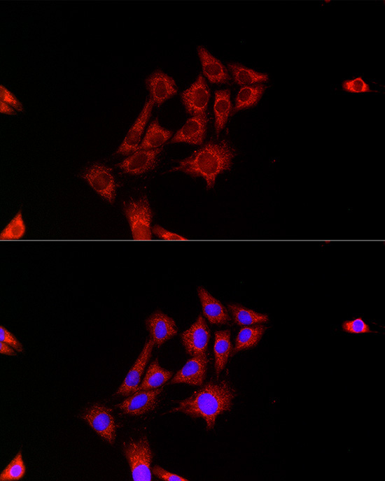 FH Rabbit Polyclonal Antibody - Image 3