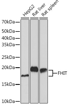 FHIT Rabbit Monoclonal Antibody