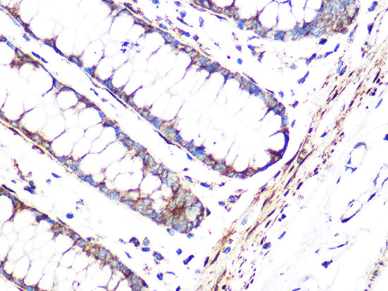 FHL1 Rabbit Monoclonal Antibody