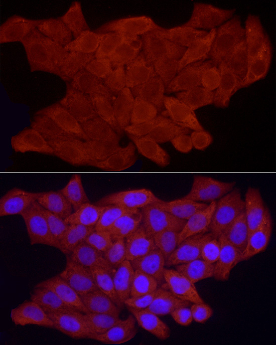 FHL3 Rabbit Polyclonal Antibody - Image 2
