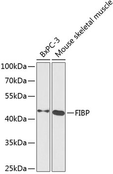 FIBP Rabbit Polyclonal Antibody