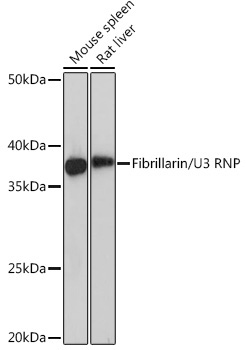 Fibrillarin/U3 RNP Rabbit Monoclonal Antibody