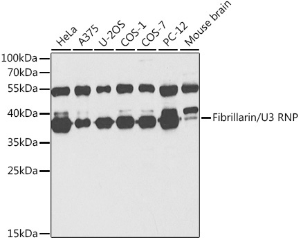 Fibrillarin/U3 RNP Rabbit Polyclonal Antibody