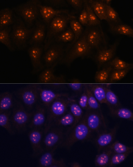 Fibrillarin/U3 RNP Rabbit Polyclonal Antibody - Image 2