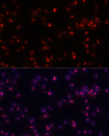 Fibrillarin/U3 RNP Rabbit Polyclonal Antibody - Image 3