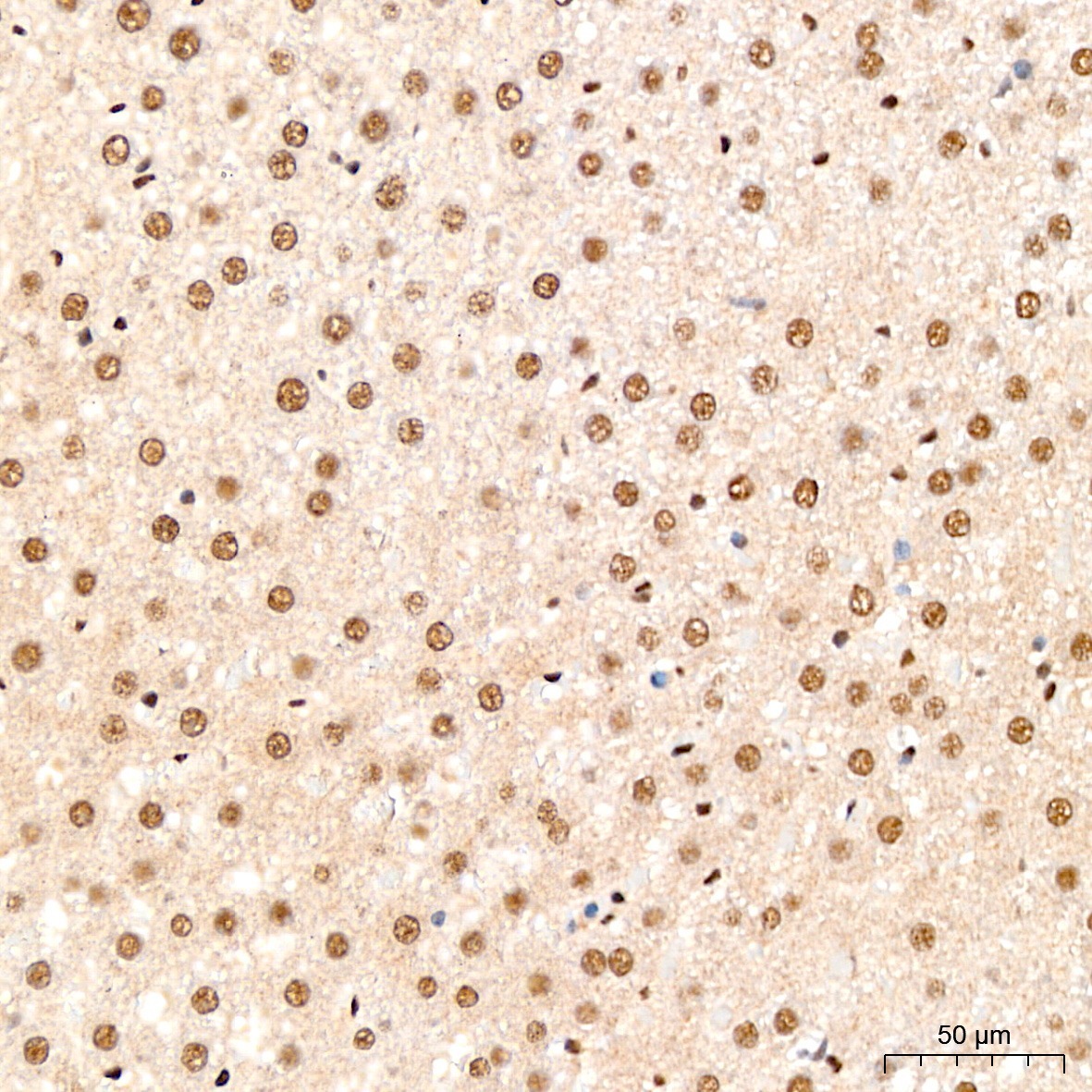 Fibrillarin/U3 RNP Rabbit Polyclonal Antibody