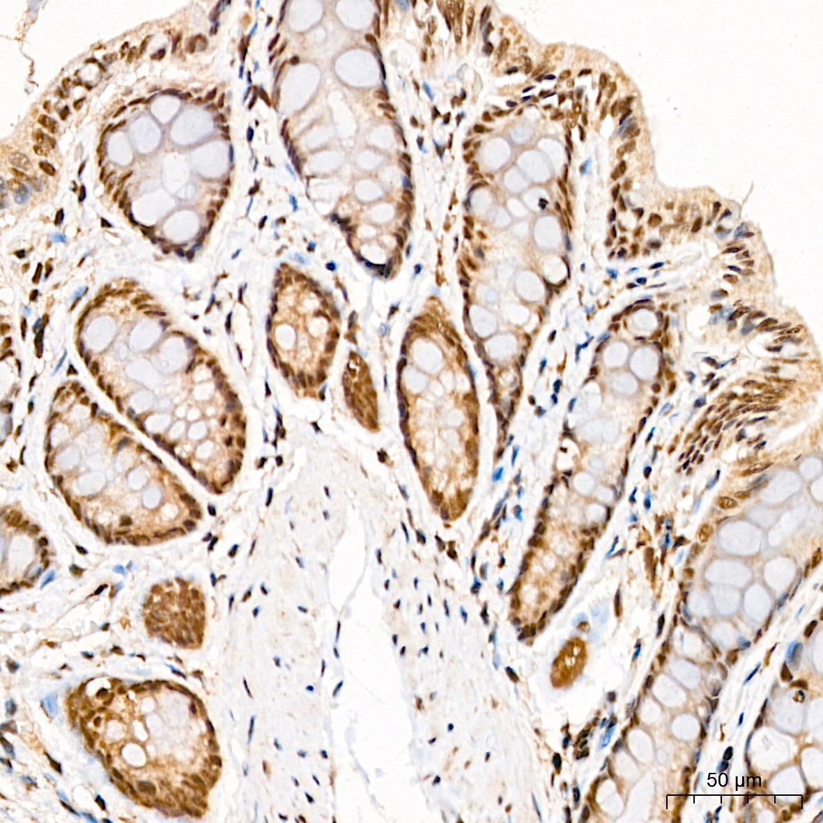 Fibrillarin/U3 RNP Rabbit Polyclonal Antibody - Image 2
