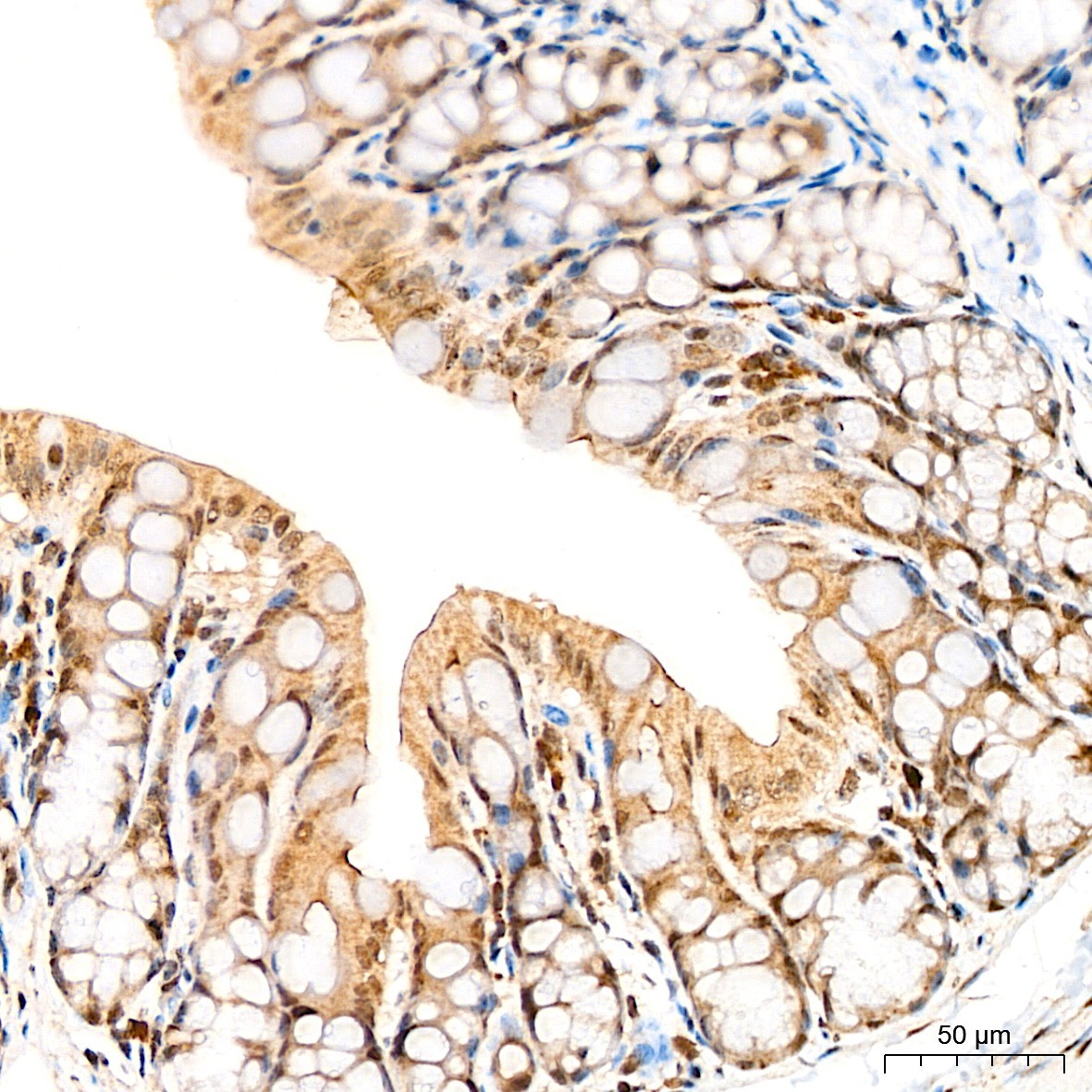 Fibrillarin/U3 RNP Rabbit Polyclonal Antibody - Image 3