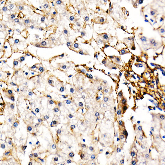 Fibrillin 1 Rabbit Polyclonal Antibody - Image 2