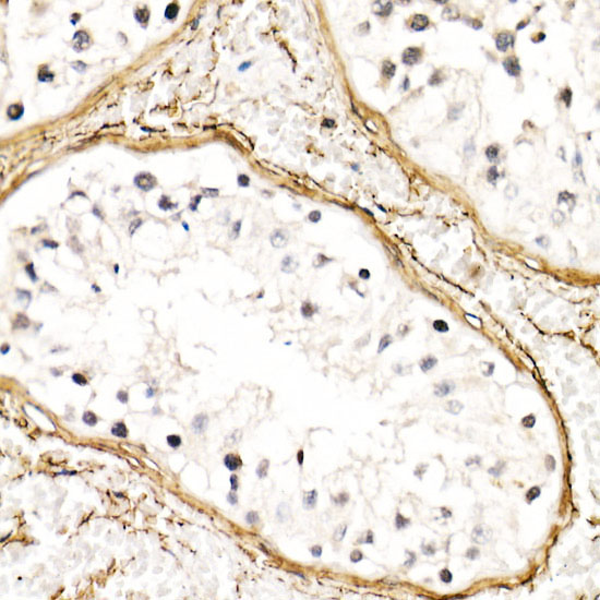 Fibrillin 1 Rabbit Polyclonal Antibody - Image 3