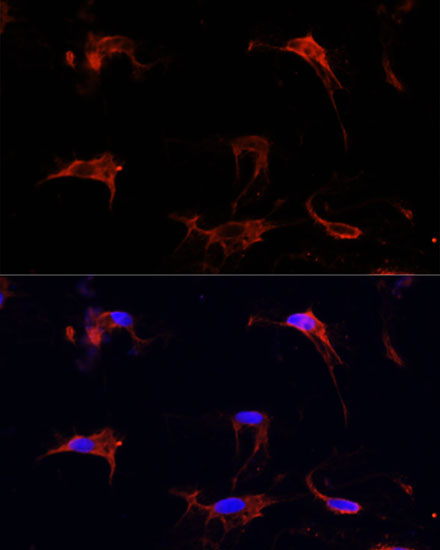 Fibrillin 1 Rabbit Polyclonal Antibody - Image 4