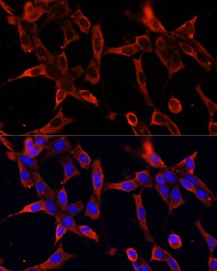 Fibrillin 1 Rabbit Polyclonal Antibody - Image 5