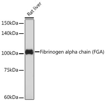 Fibrinogen alpha chain (FGA) Rabbit Monoclonal Antibody