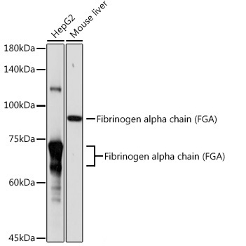 Fibrinogen alpha chain (FGA) Rabbit Polyclonal Antibody