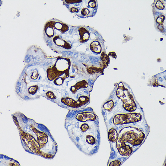 Fibrinogen alpha chain (FGA) Rabbit Polyclonal Antibody - Image 2