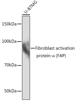 Fibroblast activation protein-Alpha (FAP) Rabbit Monoclonal Antibody