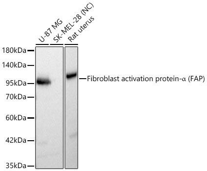 Fibroblast activation protein-Alpha (FAP) Rabbit Polyclonal Antibody