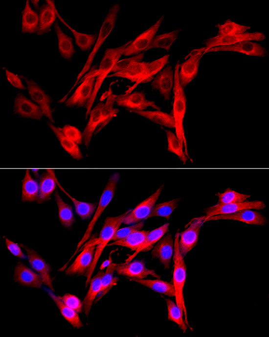 Fibroblast activation protein-Alpha (FAP) Rabbit Polyclonal Antibody - Image 2