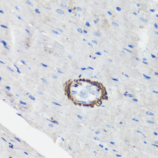 Filamin A Rabbit Polyclonal Antibody - Image 2